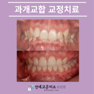 삼성동치과1