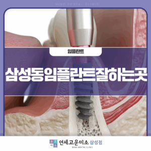 삼성동임플란트잘하는곳