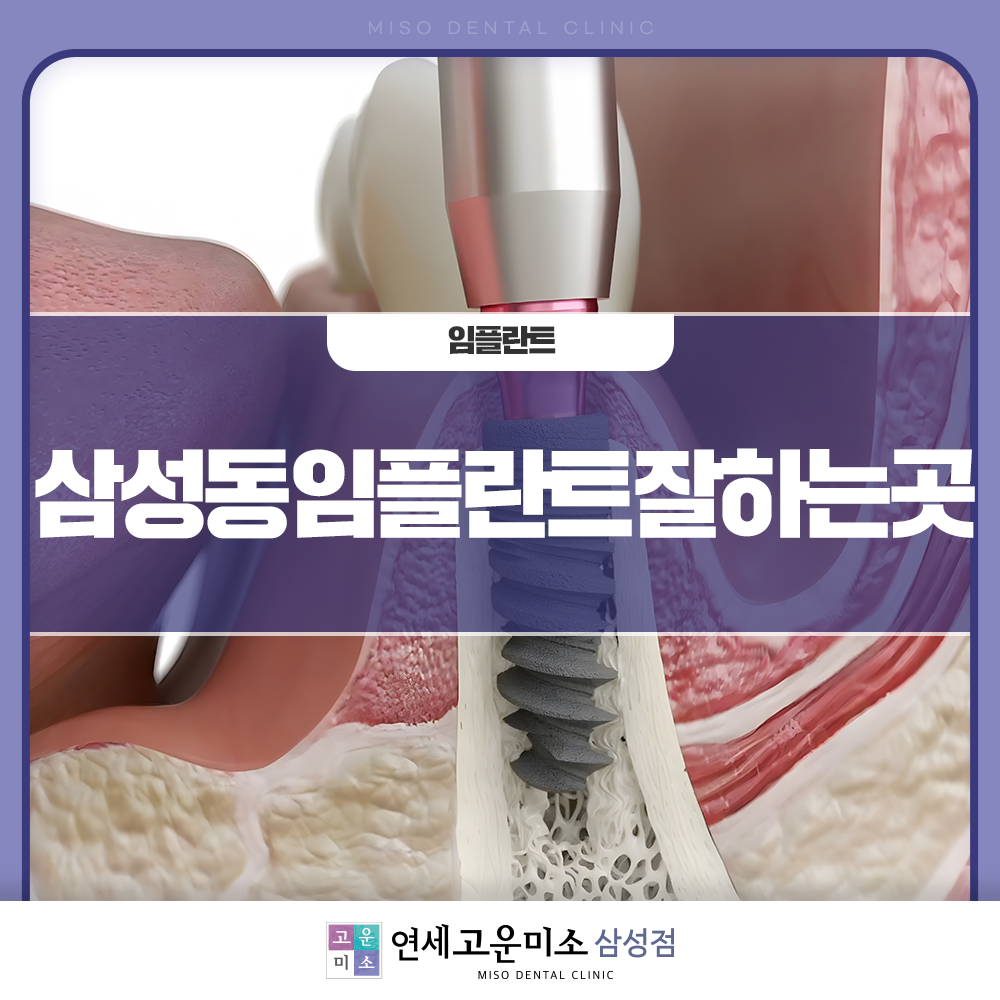 삼성동임플란트잘하는곳