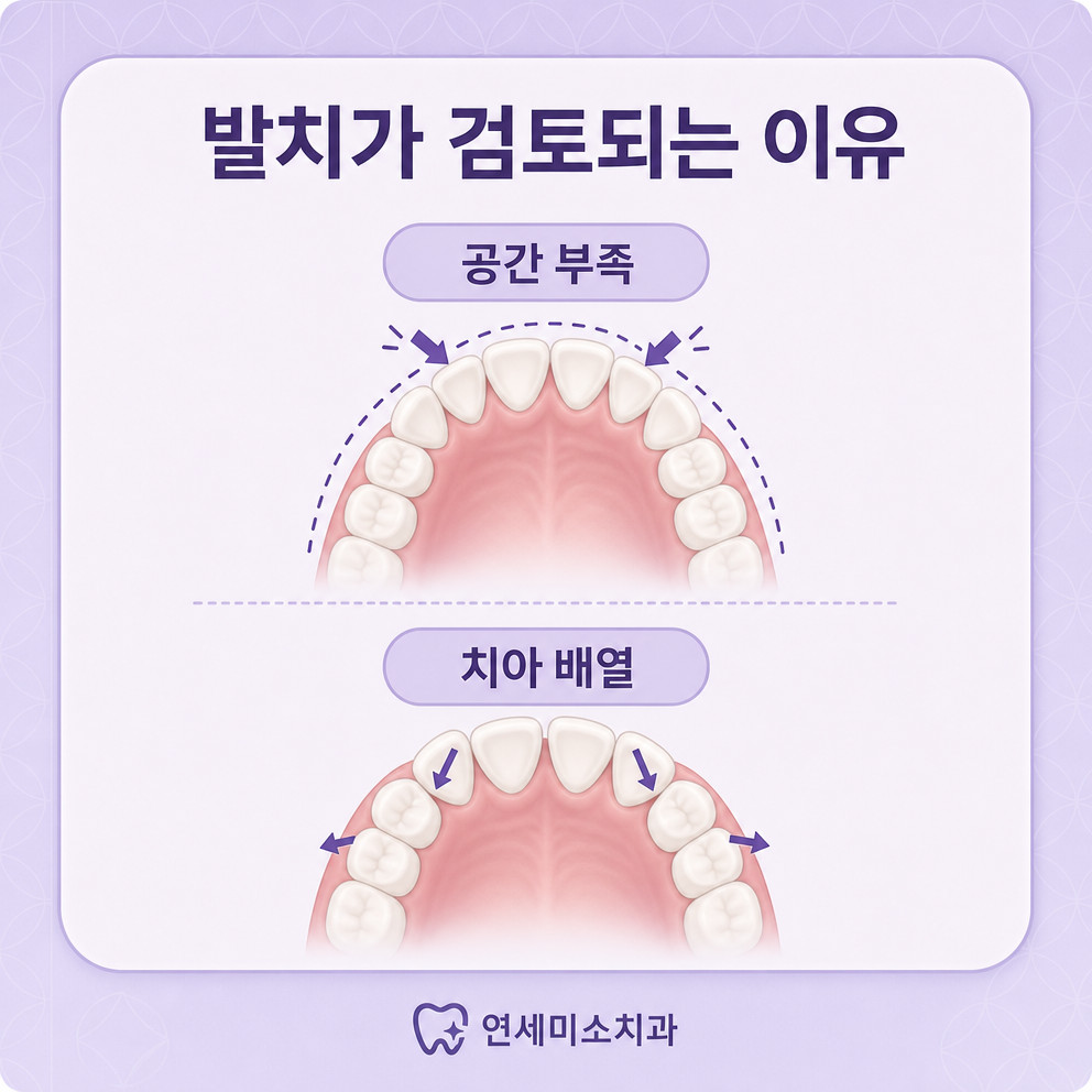 삼성역치과 치아교정 발치 의미와 공간 확보 목적 개인별 판단 기준 안내